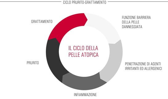 Unguenti ad atopic neurodermatitis