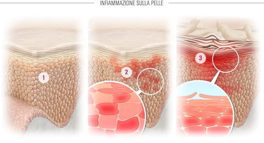 metformin high blood pressure metformin high blood pressure