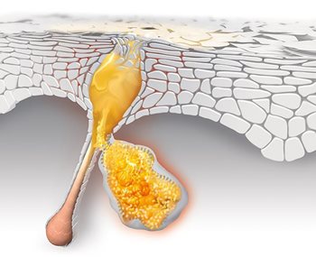 Pori aperti Pori aperti