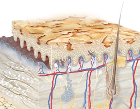 Prurito e pelle secca Prurito e pelle secca