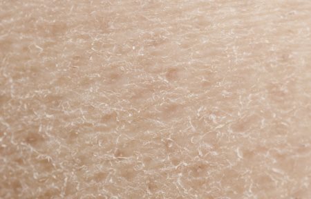 Ingrandimento della pelle secca