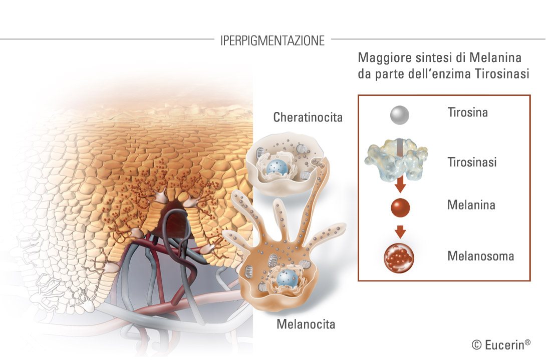 Immagine dell'aspetto della pigmentazione della pelle
